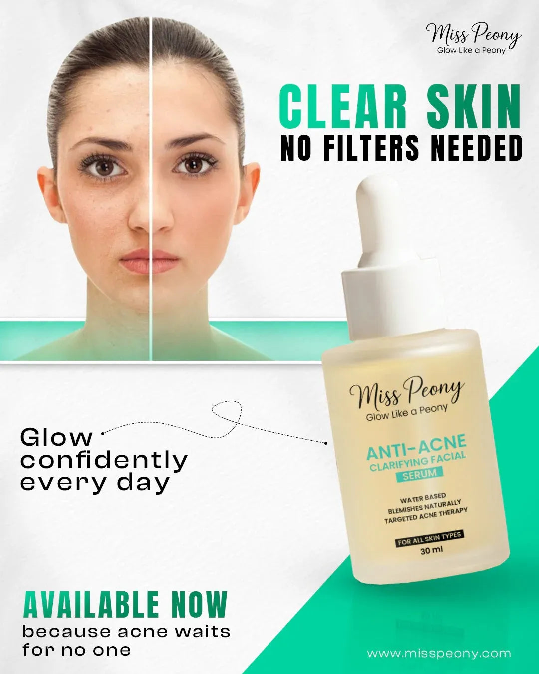 Anti-Acne Clarifying Facial Serum